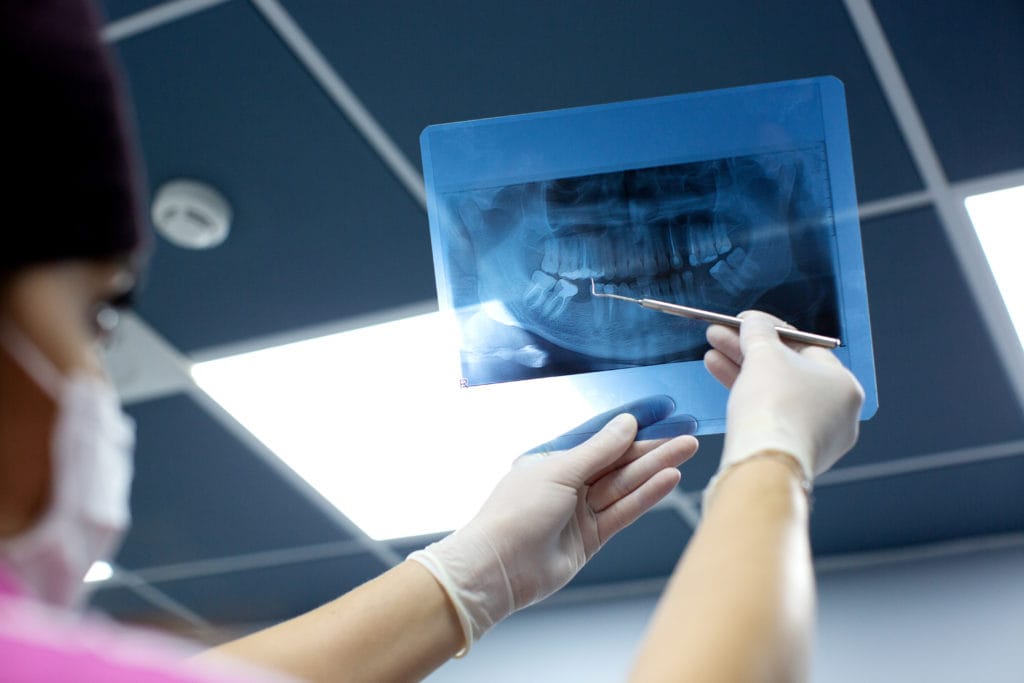 dentist checks x ray photo of mouth