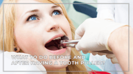 What to Do Before and After Having a Tooth Pulled?