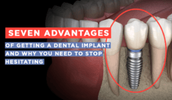 advantages of getting dental implants