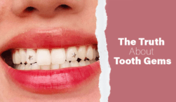 The Truth About Tooth Gems: Are They Safe or Dangerous?