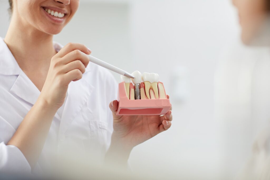 dental implants in San Diego