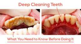 Deep Cleaning: 7 Surprising Benefits You Never Knew