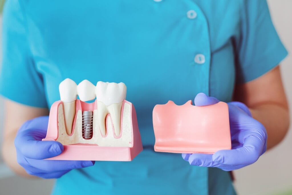 dental crowns in Clairemont