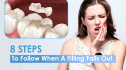 8 Steps To Follow When A Filling Falls Out