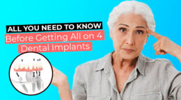 All You Need to Know Before Getting All on 4 Dental Implants