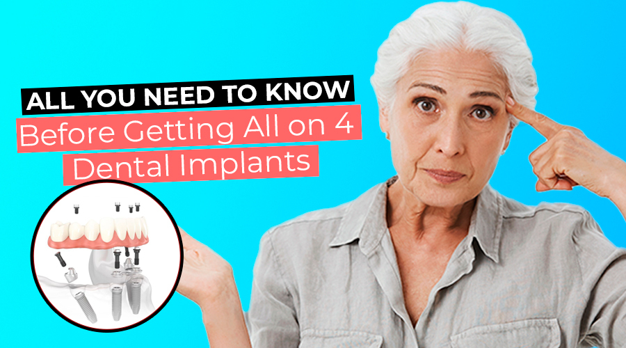 All You Need To Know Before Getting All On Dental Implants Top