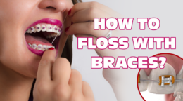 How To Floss With Braces; What You Should Know?