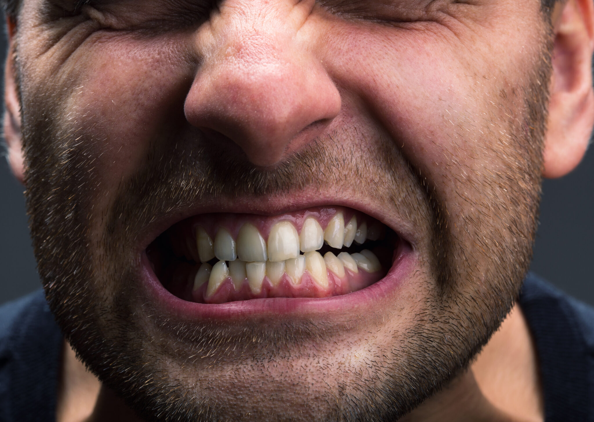 causes-of-jaw-clenching-and-tips-to-relieve-it-top-cosmetic-dentist