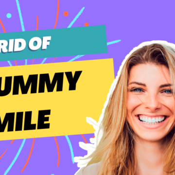 A captivating thumbnail featuring Serena Dental addressing gummy smiles.