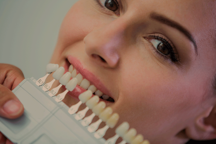 An image showcasing a flawless smile transformed by veneers.