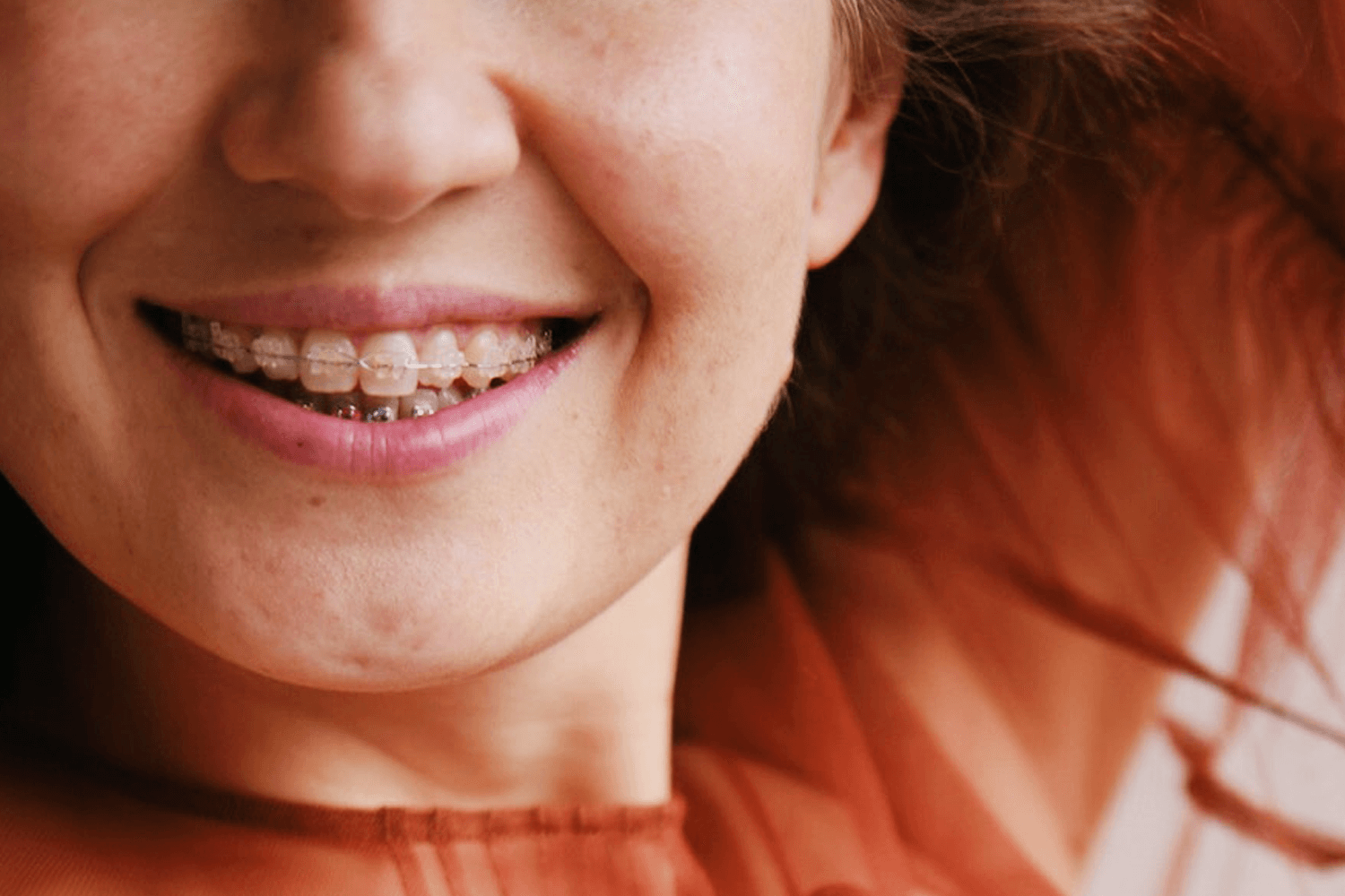 An image featuring a woman confidently showcasing her Six Month Smiles transformation.