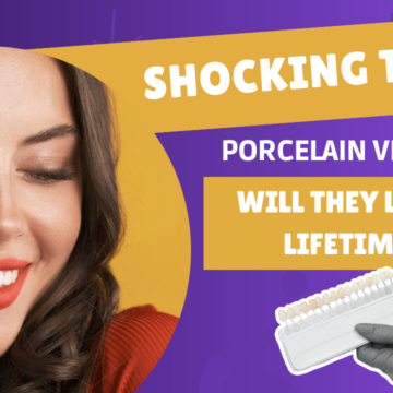 A captivating thumbnail image for the blog titled "Longevity of Porcelain Veneers" featuring a close-up of porcelain veneers.