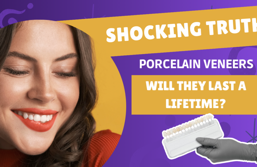 A captivating thumbnail image for the blog titled "Longevity of Porcelain Veneers" featuring a close-up of porcelain veneers.