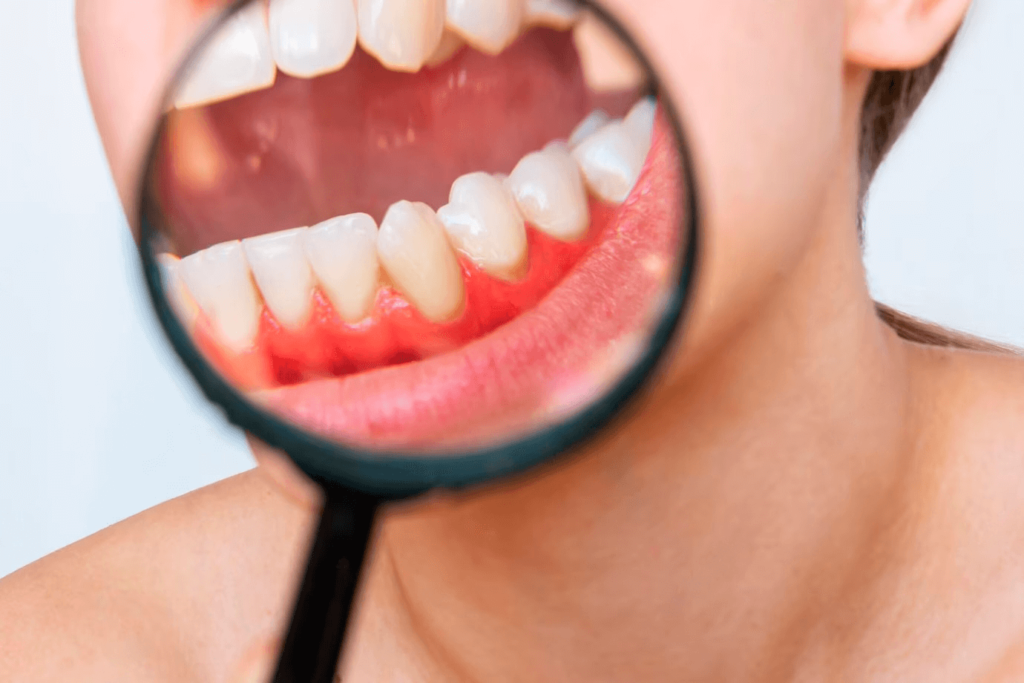 Close-up of a woman examining her teeth with a magnifying glass for signs of Gum Disease