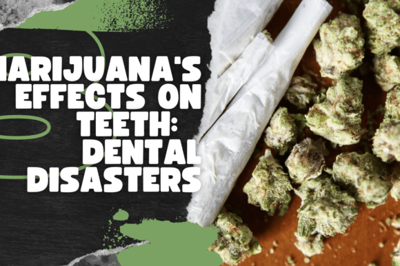 Marijuana's Effects on Teeth: Dental Disasters