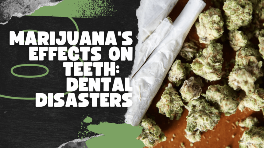 Marijuana's Effects on Teeth: Dental Disasters