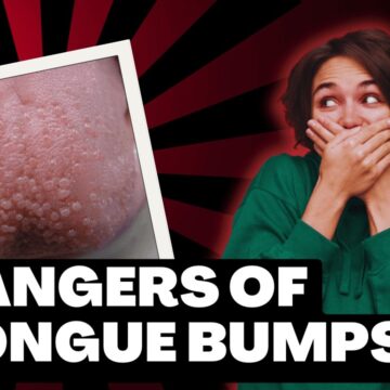 A woman covering her mouth in front of a red background, illustrating the potential dangers of tongue bumps.