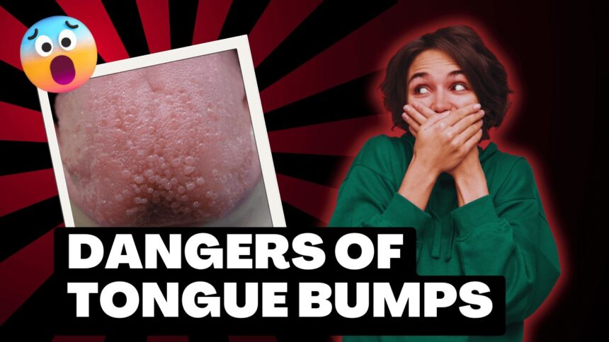 A woman covering her mouth in front of a red background, illustrating the potential dangers of tongue bumps.