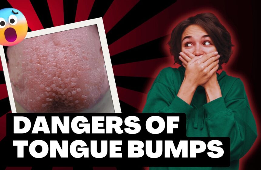 A woman covering her mouth in front of a red background, illustrating the potential dangers of tongue bumps.