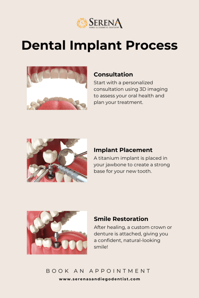 Implants dental near me