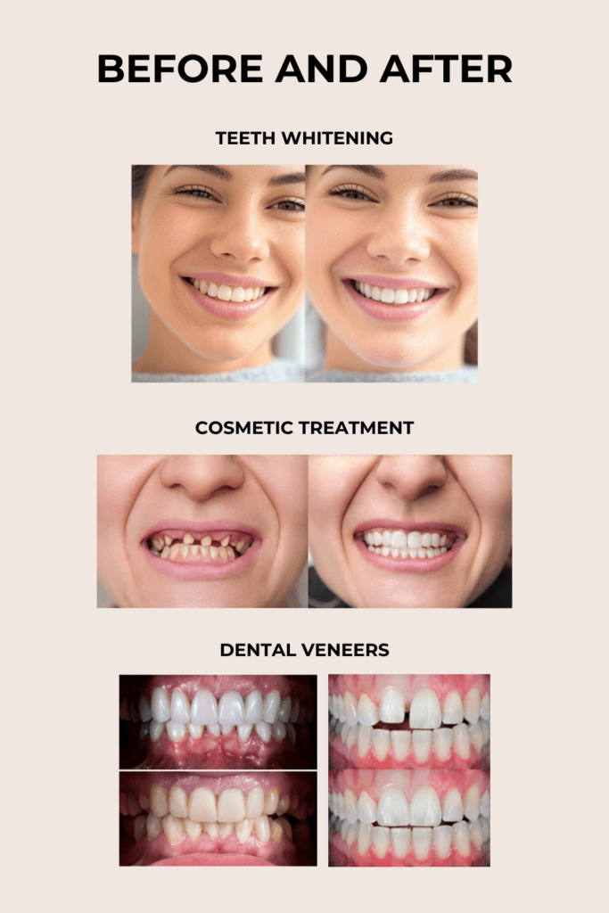 before and after dental 1