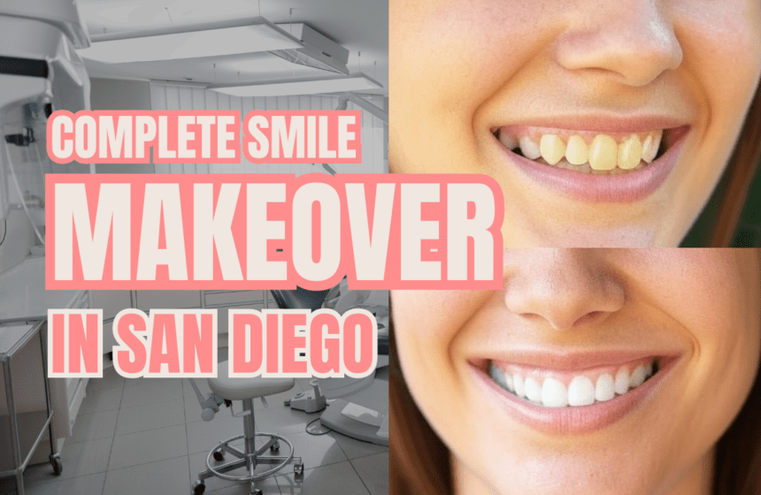 complete smile makeover