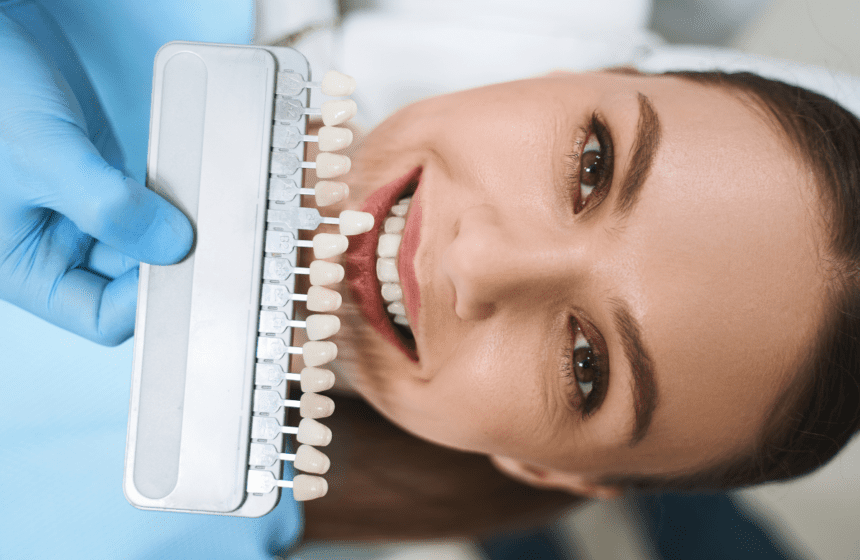 dental veneers near me