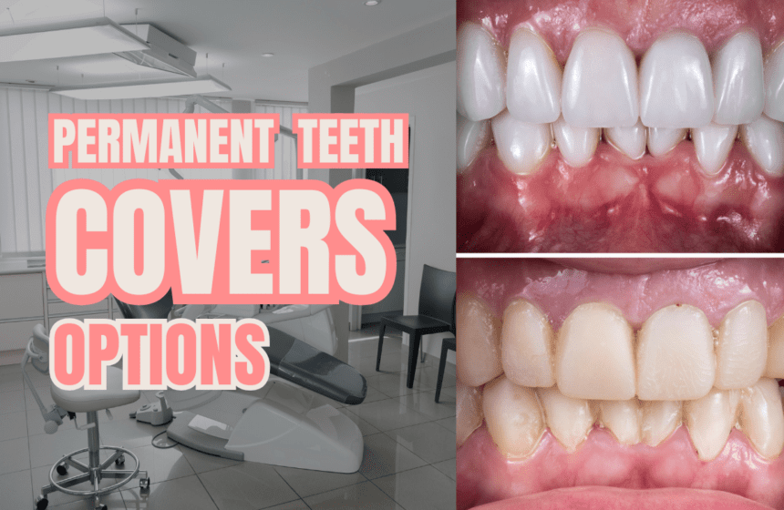 permanent teeth covers