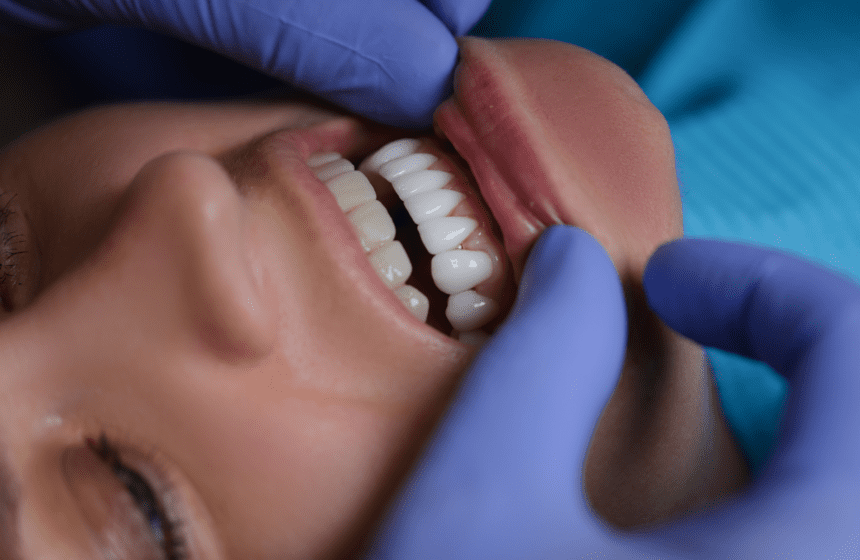 porcelain veneers cost