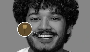 Dental implants in San Diego