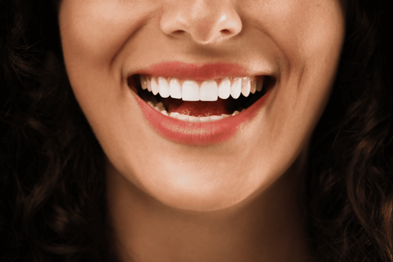 Professional teeth whitening in San Diego