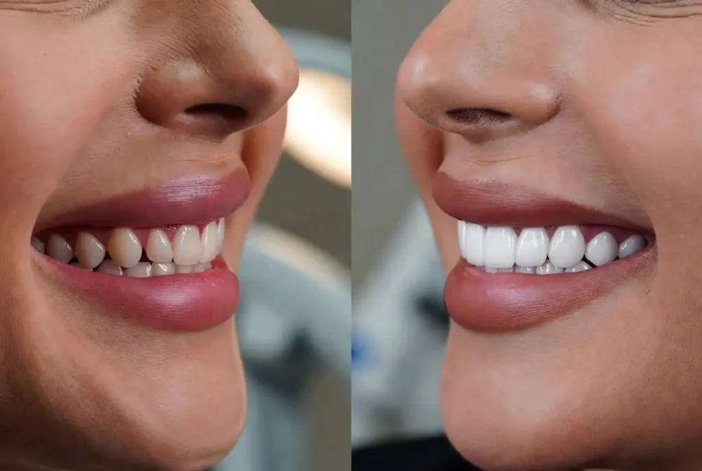 Transform Your Look with Expert Cosmetic Dentistry