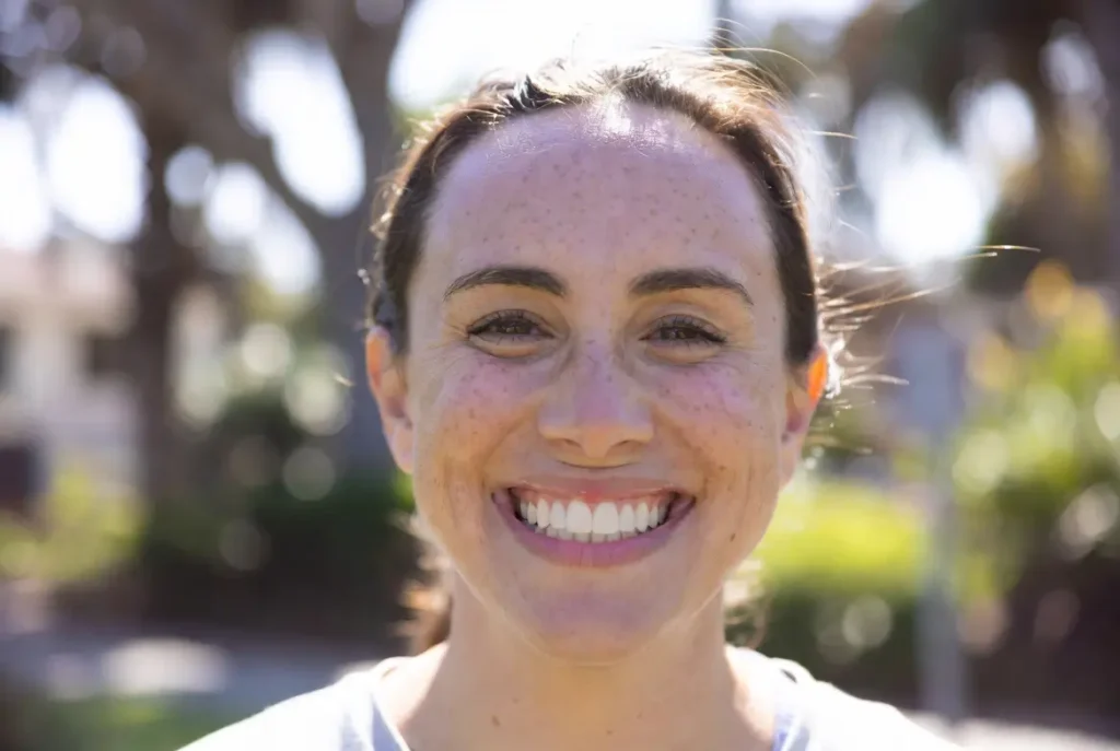 Full Smile Makeover Clairemont