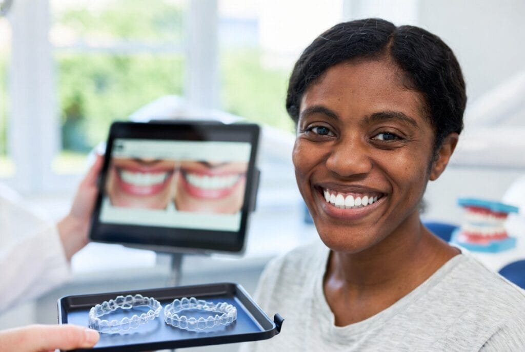 How to Fix Crooked Teeth Without Braces