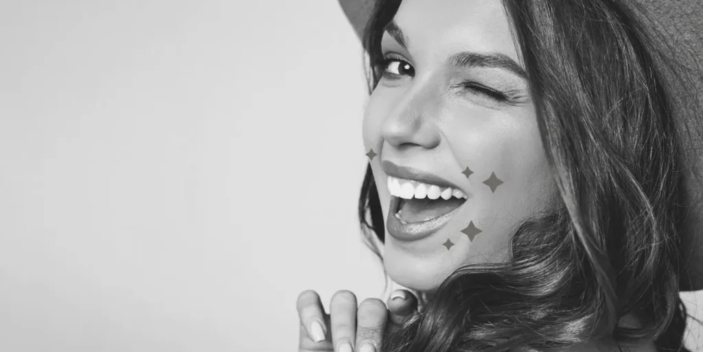Are Veneers