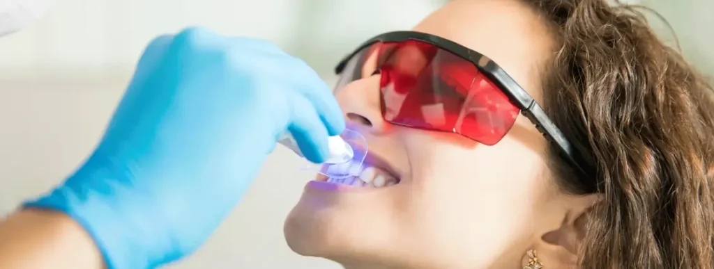 Professional Teeth Whitening
